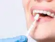 Alternatives aux implants dentaires : options et considérations