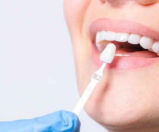 Alternatives aux implants dentaires : options et considérations